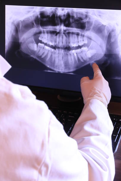 Best Emergency Dental Care for Broken or Chipped Teeth in East Niles, CA